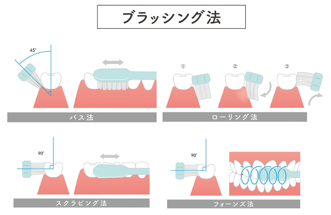 正しいブラッシング